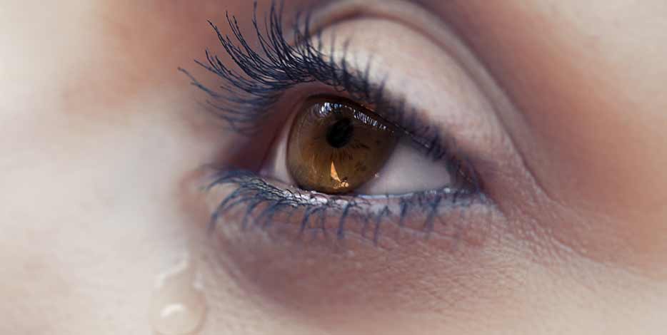 Close up of watery eye condition with teardrop falling from eyelid
